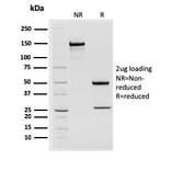 SDS-PAGE - Anti-STAT2 Antibody [STAT2/2650] - BSA and Azide free (A253241) - Antibodies.com