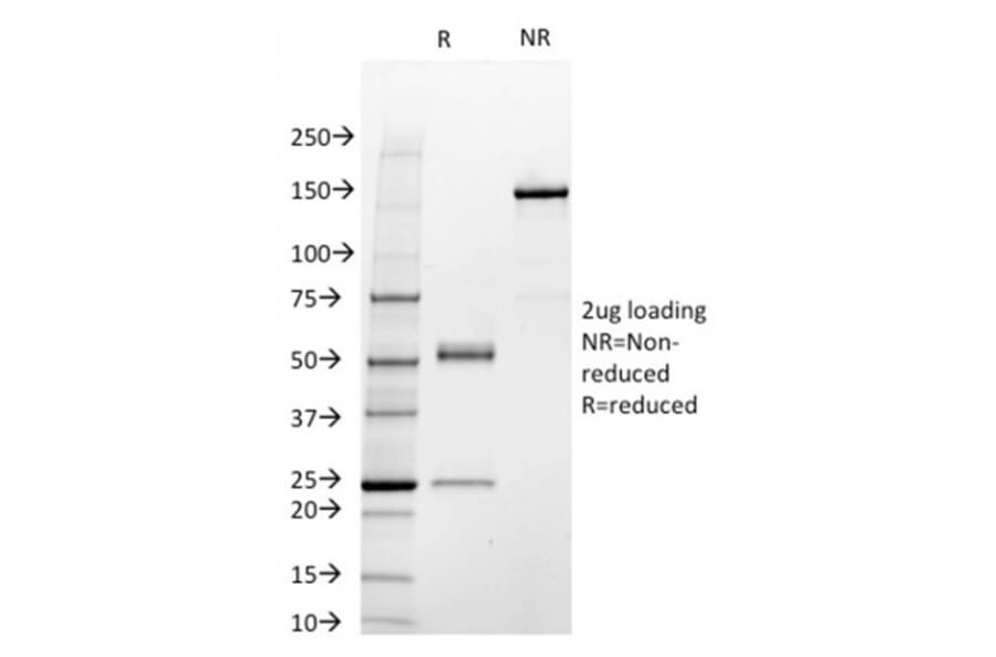 SDS-PAGE - Anti-STAT3 Antibody [STAT3/2409] - BSA and Azide free (A253242) - Antibodies.com