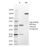 SDS-PAGE - Anti-STAT3 Antibody [STAT3/2409] - BSA and Azide free (A253242) - Antibodies.com