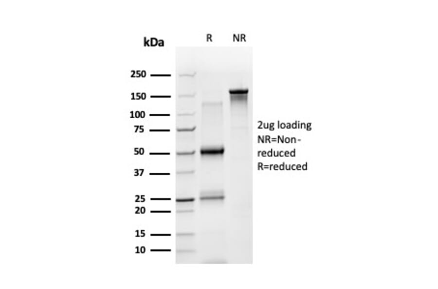 SDS-PAGE - Anti-STAT5A Antibody [PCRP-STAT5A-1A9] - BSA and Azide free (A253244) - Antibodies.com