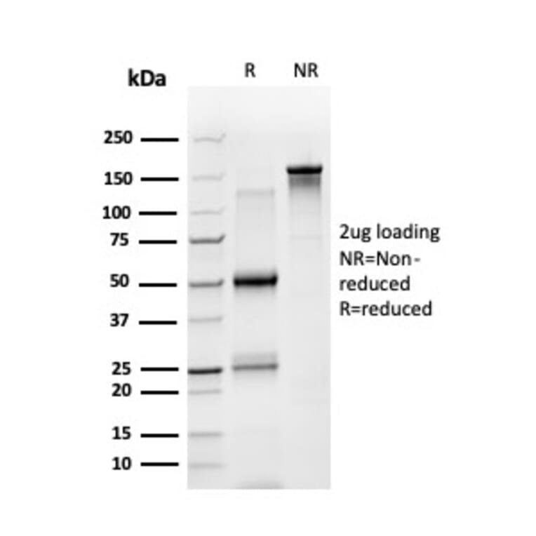 SDS-PAGE - Anti-STAT5A Antibody [PCRP-STAT5A-1A9] - BSA and Azide free (A253244) - Antibodies.com