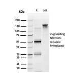 SDS-PAGE - Anti-STAT5A Antibody [PCRP-STAT5A-1A9] - BSA and Azide free (A253244) - Antibodies.com