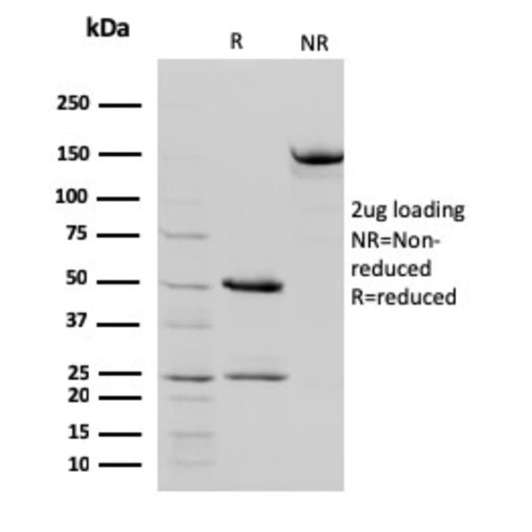 SDS-PAGE - Anti-STAT5B Antibody [STAT5B/2657] - BSA and Azide free (A253246) - Antibodies.com
