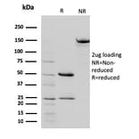 SDS-PAGE - Anti-STAT5B Antibody [STAT5B/2657] - BSA and Azide free (A253246) - Antibodies.com