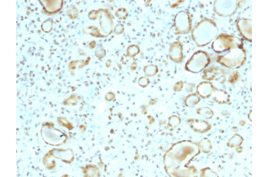 Immunohistochemistry - Anti-STAT6 Antibody [STAT6/2410] - BSA and Azide free (A253247) - Antibodies.com