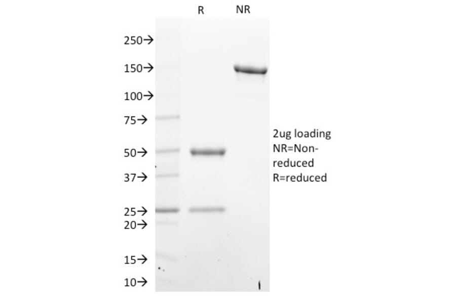 SDS-PAGE - Anti-STAT6 Antibody [STAT6/2410] - BSA and Azide free (A253247) - Antibodies.com