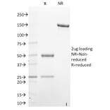 SDS-PAGE - Anti-STAT6 Antibody [STAT6/2410] - BSA and Azide free (A253247) - Antibodies.com