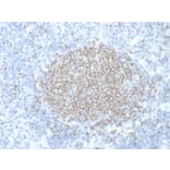 Immunohistochemistry - Anti-Estrogen Sulfotransferase Antibody [CPTC-SULT1E1-1] - BSA and Azide free (A253247) - Antibodies.com