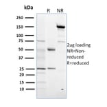 SDS-PAGE - Anti-Estrogen Sulfotransferase Antibody [CPTC-SULT1E1-1] - BSA and Azide free (A253248) - Antibodies.com