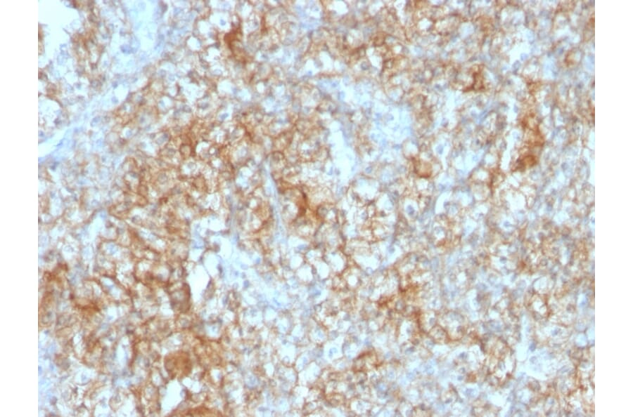Immunohistochemistry - Anti-CD147 Antibody [8D6] - BSA and Azide free (A253248) - Antibodies.com