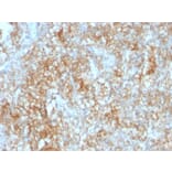 Immunohistochemistry - Anti-CD147 Antibody [8D6] - BSA and Azide free (A253248) - Antibodies.com
