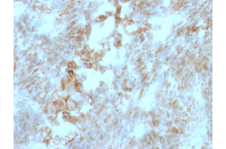 Immunohistochemistry - Anti-CD147 Antibody [BSG/963] - BSA and Azide free (A253249) - Antibodies.com