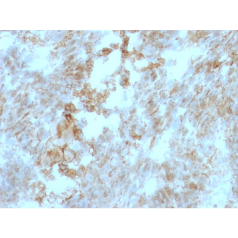 Immunohistochemistry - Anti-CD147 Antibody [BSG/963] - BSA and Azide free (A253249) - Antibodies.com