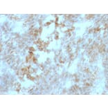 Immunohistochemistry - Anti-CD147 Antibody [BSG/963] - BSA and Azide free (A253249) - Antibodies.com