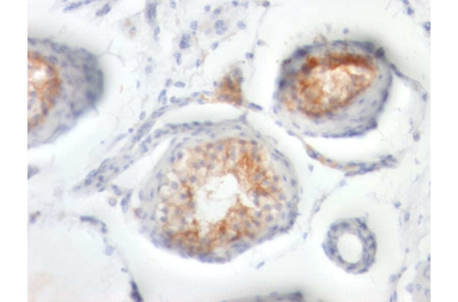 Immunohistochemistry - Anti-CD147 Antibody [BSG/963] - BSA and Azide free (A253250) - Antibodies.com