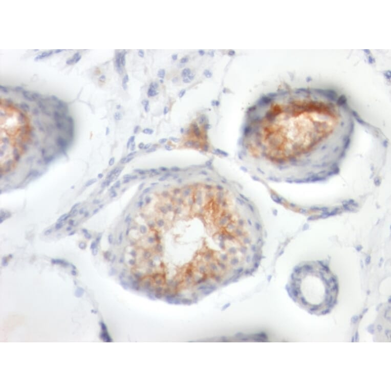 Immunohistochemistry - Anti-CD147 Antibody [BSG/963] - BSA and Azide free (A253250) - Antibodies.com