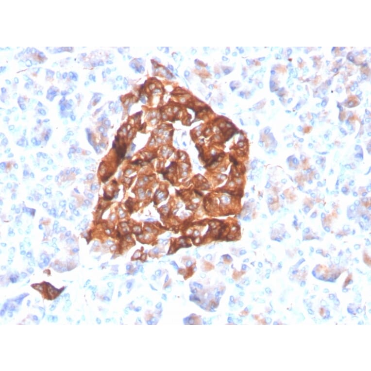 Immunohistochemistry - Anti-Synaptophysin Antibody [SYP/4503R] - BSA and Azide free (A253252) - Antibodies.com