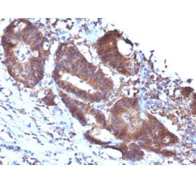 Immunohistochemistry - Anti-Transgelin Antibody [TAGLN/247] - BSA and Azide free (A253254) - Antibodies.com