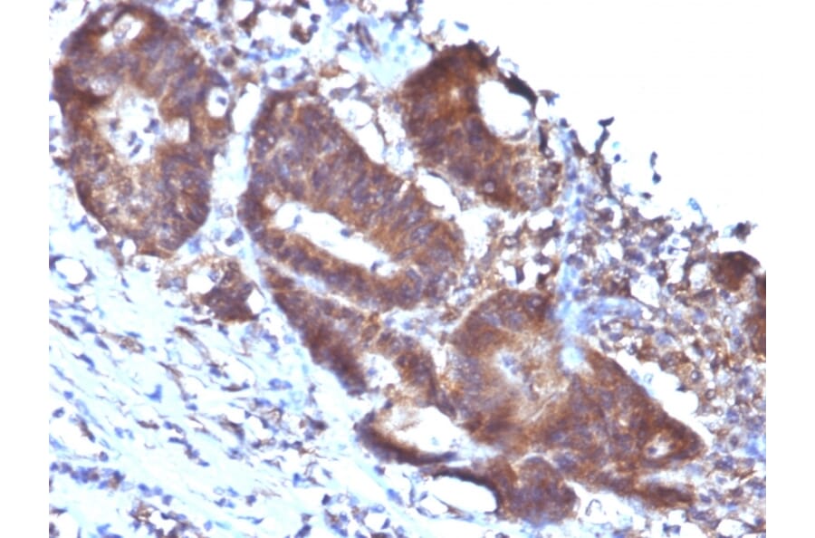 Immunohistochemistry - Anti-Transgelin Antibody [TAGLN/247] - BSA and Azide free (A253254) - Antibodies.com