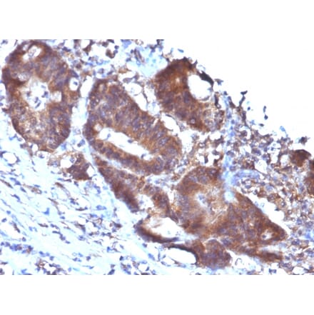 Immunohistochemistry - Anti-Transgelin Antibody [TAGLN/247] - BSA and Azide free (A253254) - Antibodies.com