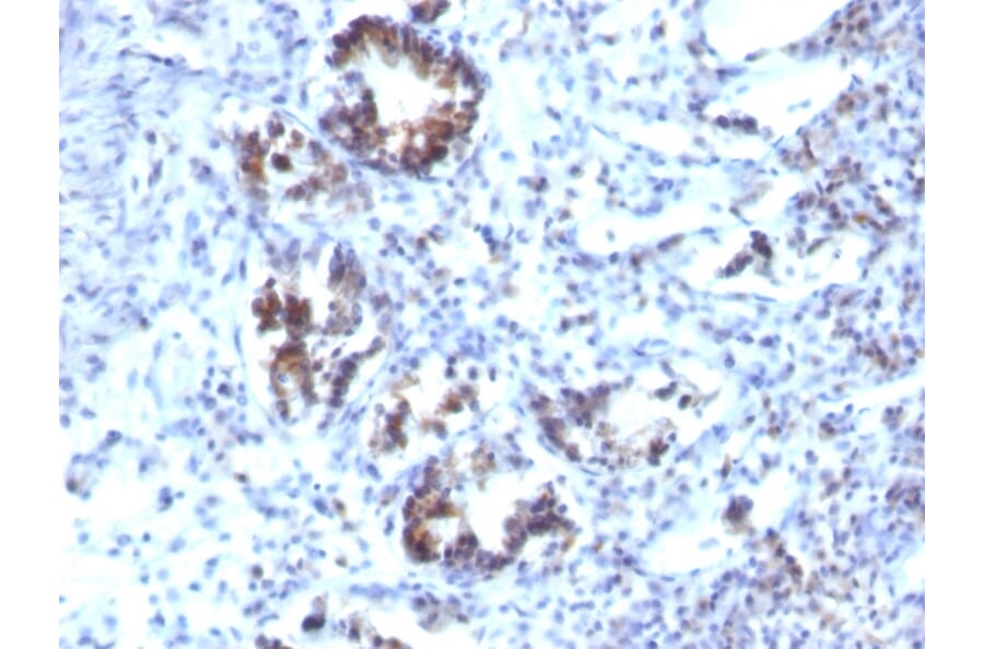 Immunohistochemistry - Anti-Transgelin Antibody [SPM606] - BSA and Azide free (A253254) - Antibodies.com