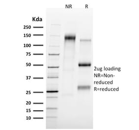 SDS-PAGE - Anti-Tal1 Antibody [TAL1/2707] - BSA and Azide free (A253255) - Antibodies.com