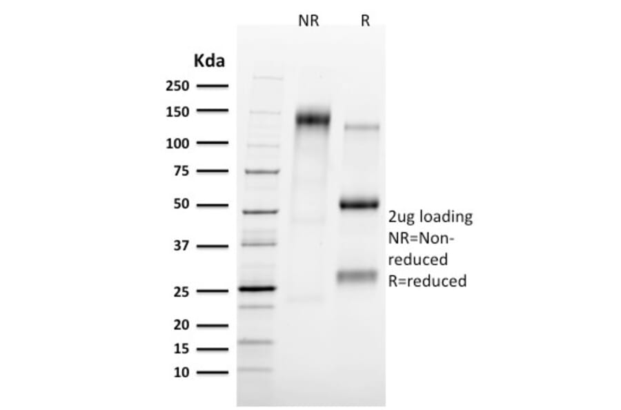 SDS-PAGE - Anti-Tal1 Antibody [TAL1/2707] - BSA and Azide free (A253255) - Antibodies.com