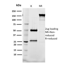 SDS-PAGE - Anti-Tal1 Antibody [BTL73] - BSA and Azide free (A253256) - Antibodies.com
