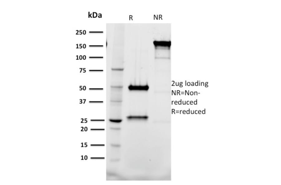 SDS-PAGE - Anti-Tal1 Antibody [BTL73] - BSA and Azide free (A253256) - Antibodies.com