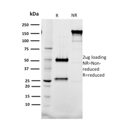SDS-PAGE - Anti-Tal1 Antibody [BTL73] - BSA and Azide free (A253256) - Antibodies.com