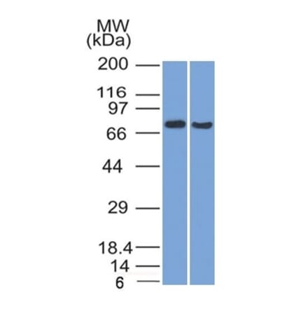 Western Blot - Anti-TCF4 Antibody [TCF4/1705] - BSA and Azide free (A253260) - Antibodies.com