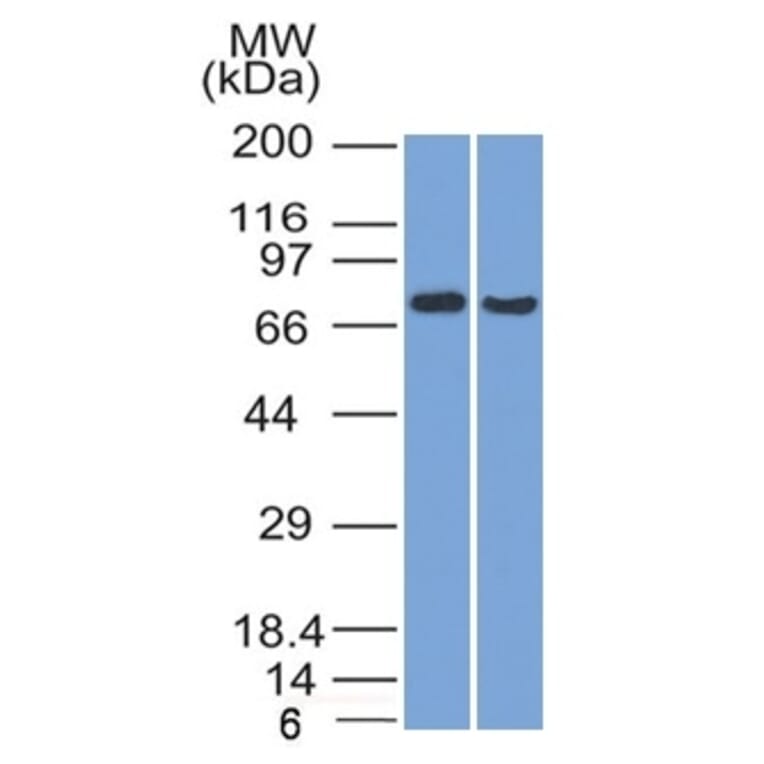 Western Blot - Anti-TCF4 Antibody [TCF4/1705] - BSA and Azide free (A253260) - Antibodies.com