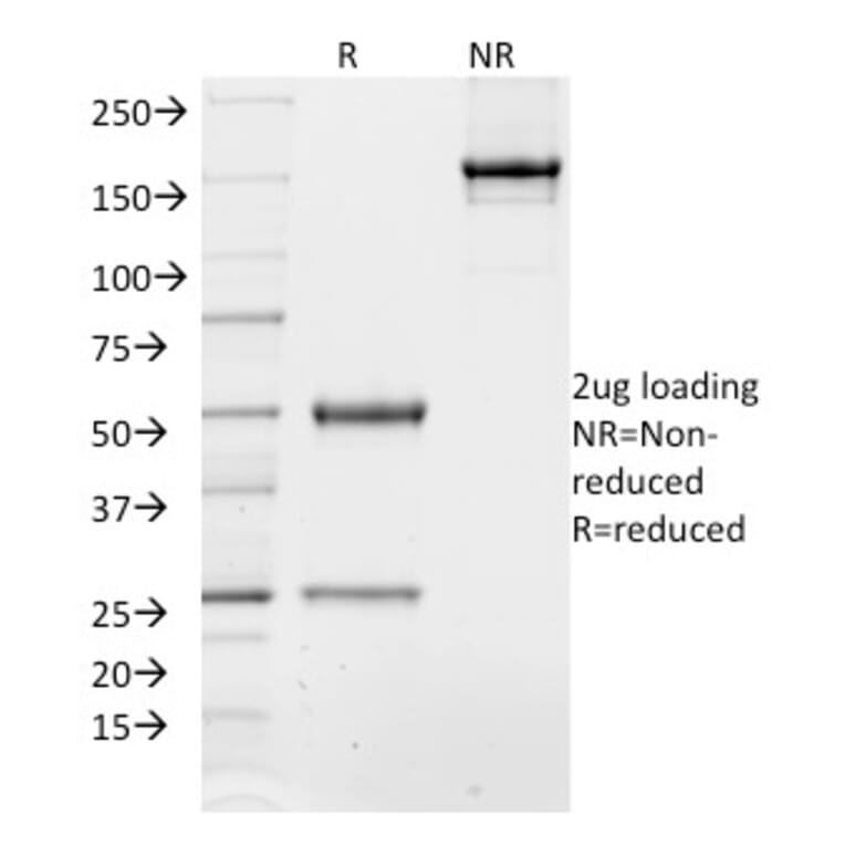SDS-PAGE - Anti-TCF4 Antibody [TCF4/1705] - BSA and Azide free (A253260) - Antibodies.com