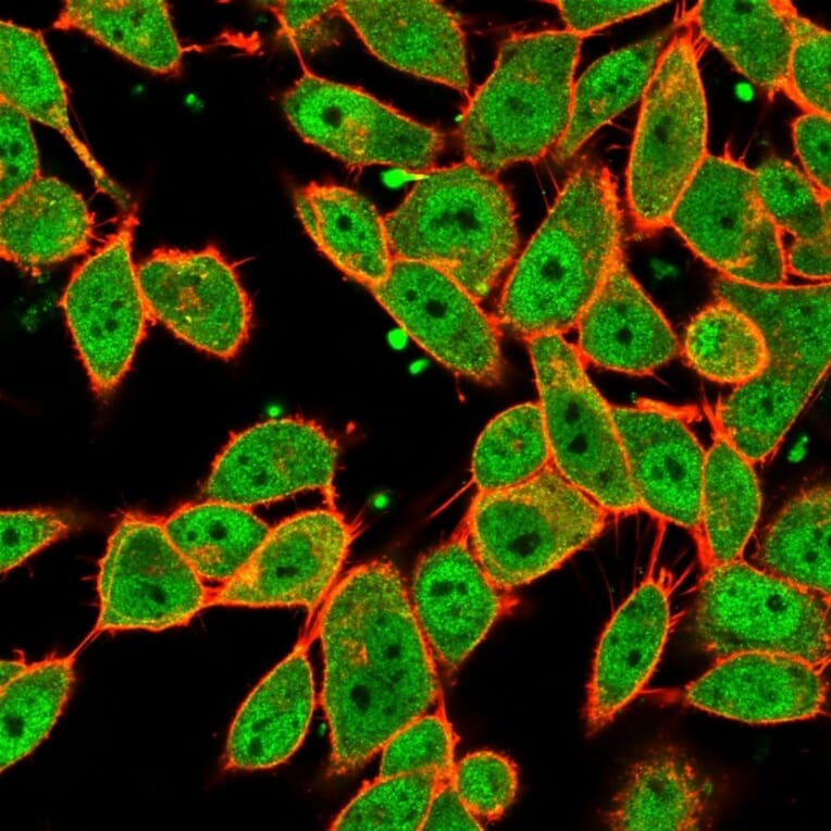 Immunofluorescence - Anti-MLX Antibody [PCRP-MLX-1G8] - BSA and Azide free (A253262) - Antibodies.com