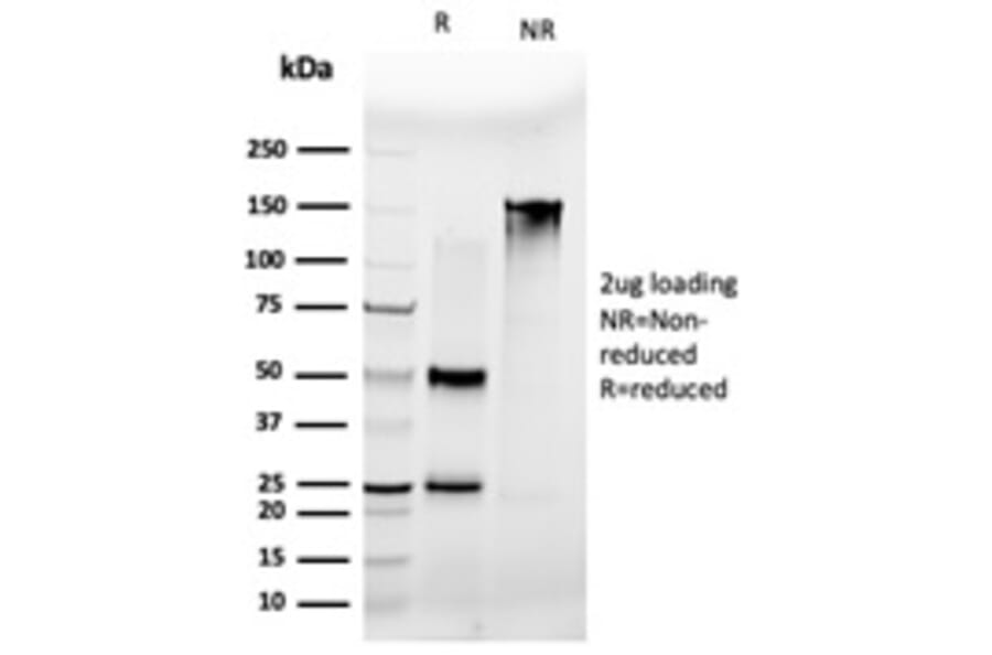 SDS-PAGE - Anti-MLX Antibody [PCRP-MLX-1G8] - BSA and Azide free (A253262) - Antibodies.com