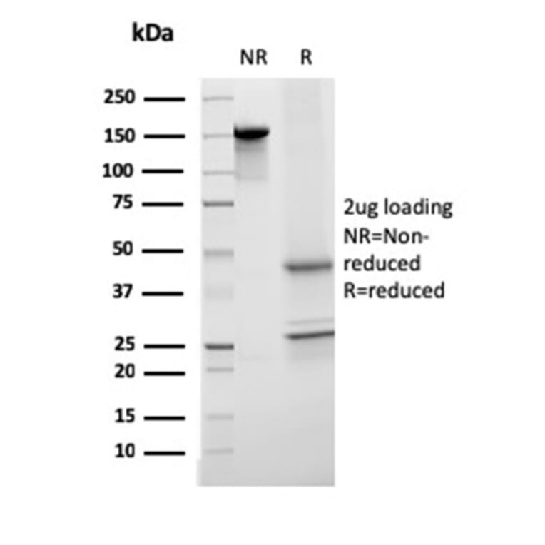 SDS-PAGE - Anti-Transferrin Antibody [TF/3001] - BSA and Azide free (A253263) - Antibodies.com