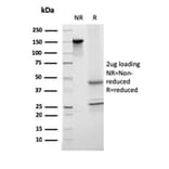 SDS-PAGE - Anti-Transferrin Antibody [TF/3001] - BSA and Azide free (A253263) - Antibodies.com