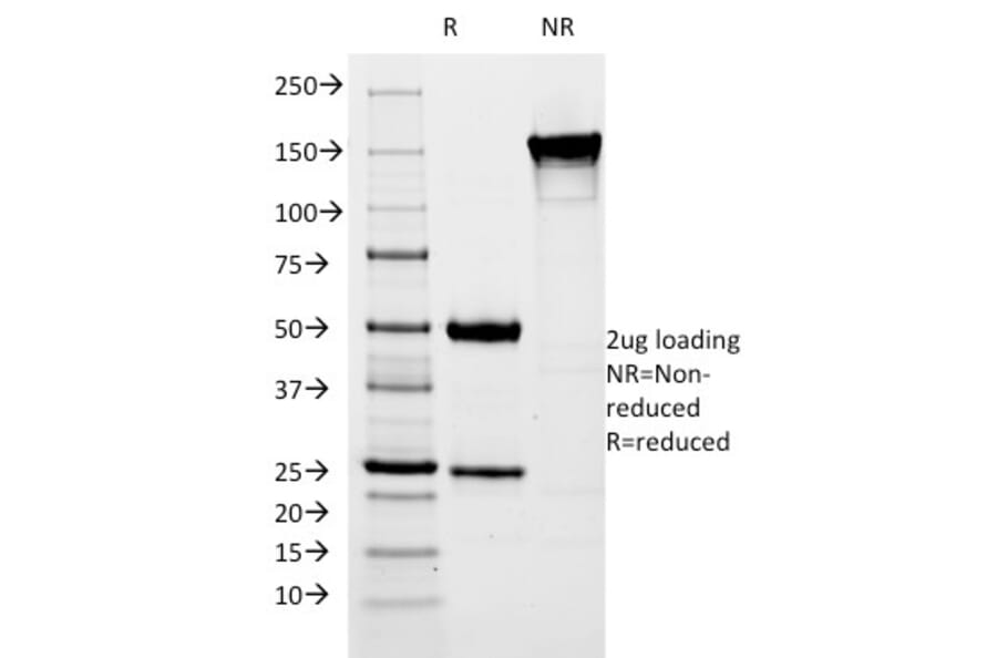 SDS-PAGE - Anti-Estrogen Inducible Protein pS5 Antibody [SPM313] - BSA and Azide free (A253266) - Antibodies.com