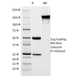 SDS-PAGE - Anti-Estrogen Inducible Protein pS5 Antibody [SPM313] - BSA and Azide free (A253266) - Antibodies.com