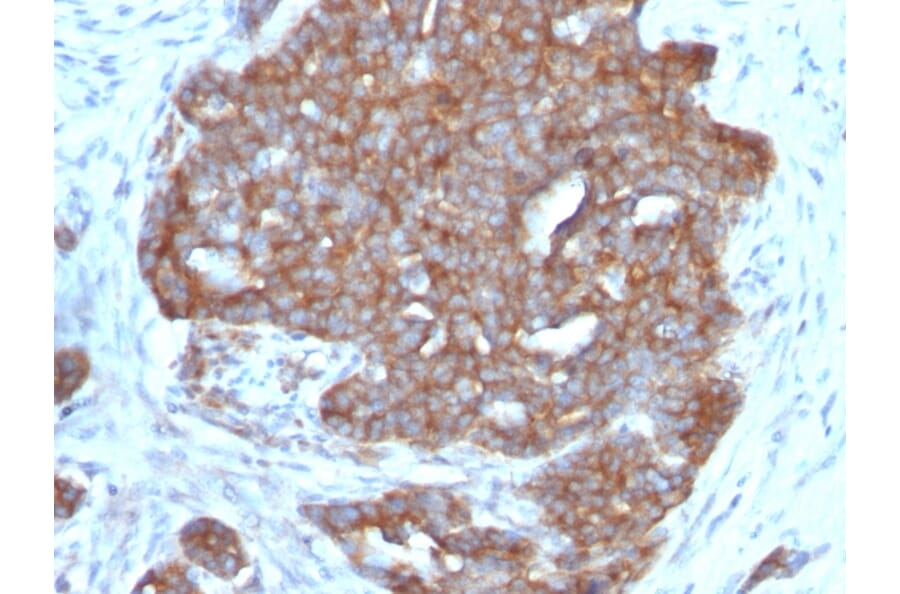 Immunohistochemistry - Anti-Estrogen Inducible Protein pS7 Antibody [TFF1/1091] - BSA and Azide free (A250087) - Antibodies.com