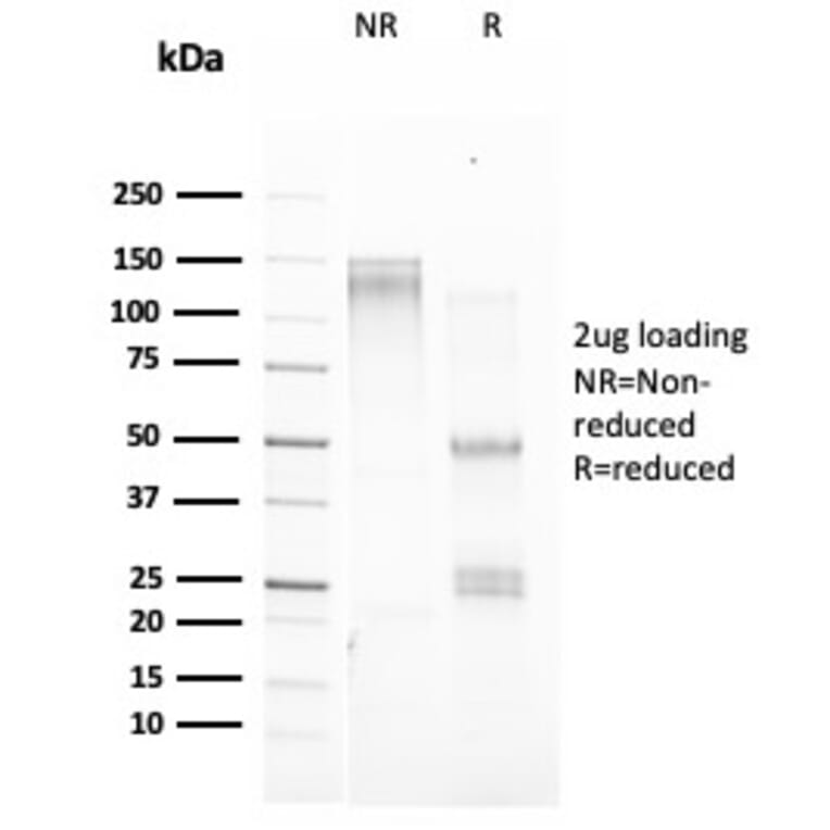 SDS-PAGE - Anti-Estrogen Inducible Protein pS2 Antibody [TFF1/2133] - BSA and Azide free (A253268) - Antibodies.com