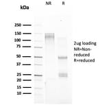 SDS-PAGE - Anti-Estrogen Inducible Protein pS2 Antibody [TFF1/2133] - BSA and Azide free (A253268) - Antibodies.com