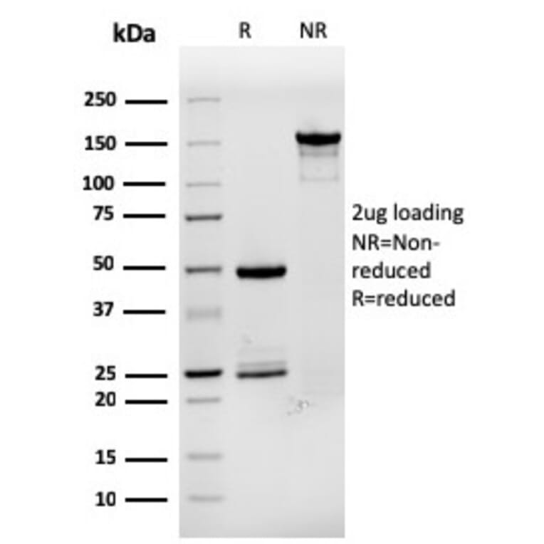 SDS-PAGE - Anti-Estrogen Inducible Protein pS8 Antibody [rTFF1/1091] - BSA and Azide free (A250089) - Antibodies.com