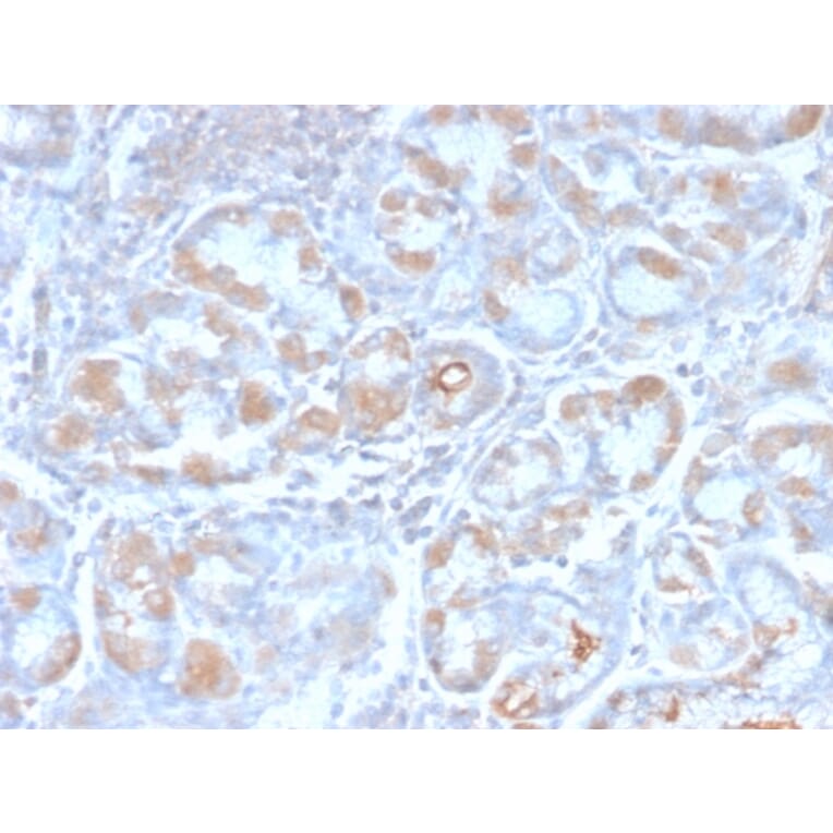 Immunohistochemistry - Anti-Estrogen Inducible Protein pS6 Antibody [TFF1/2969R] - BSA and Azide free (A253269) - Antibodies.com