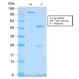 SDS-PAGE - Anti-Estrogen Inducible Protein pS6 Antibody [TFF1/2969R] - BSA and Azide free (A253270) - Antibodies.com