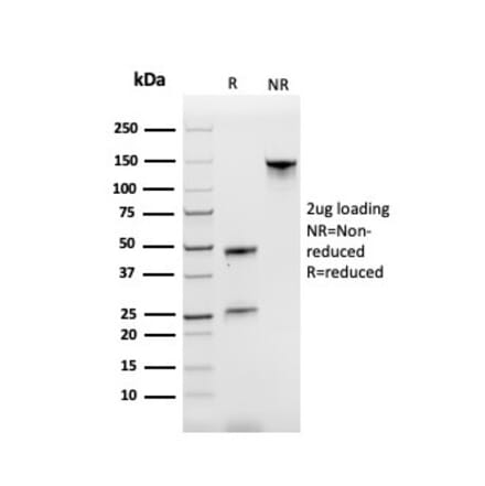 SDS-PAGE - Anti-Transferrin Receptor Antibody [TFRC/3630] - BSA and Azide free (A253271) - Antibodies.com
