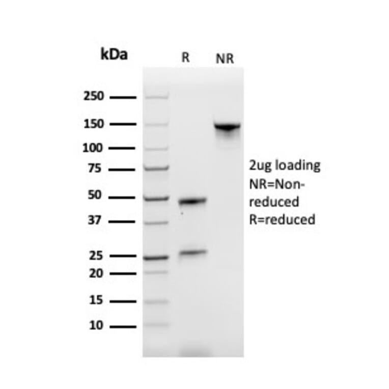 SDS-PAGE - Anti-Transferrin Receptor Antibody [TFRC/3630] - BSA and Azide free (A253271) - Antibodies.com