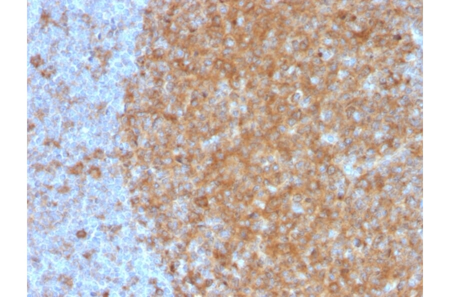Immunohistochemistry - Anti-Transferrin Receptor Antibody [TFRC/3630] - BSA and Azide free (A253271) - Antibodies.com