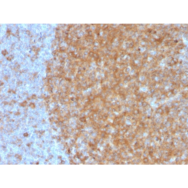 Immunohistochemistry - Anti-Transferrin Receptor Antibody [TFRC/3630] - BSA and Azide free (A253271) - Antibodies.com