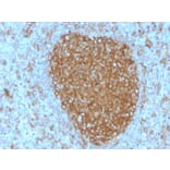 Immunohistochemistry - Anti-Transferrin Receptor Antibody [TFRC/3630] - BSA and Azide free (A253271) - Antibodies.com